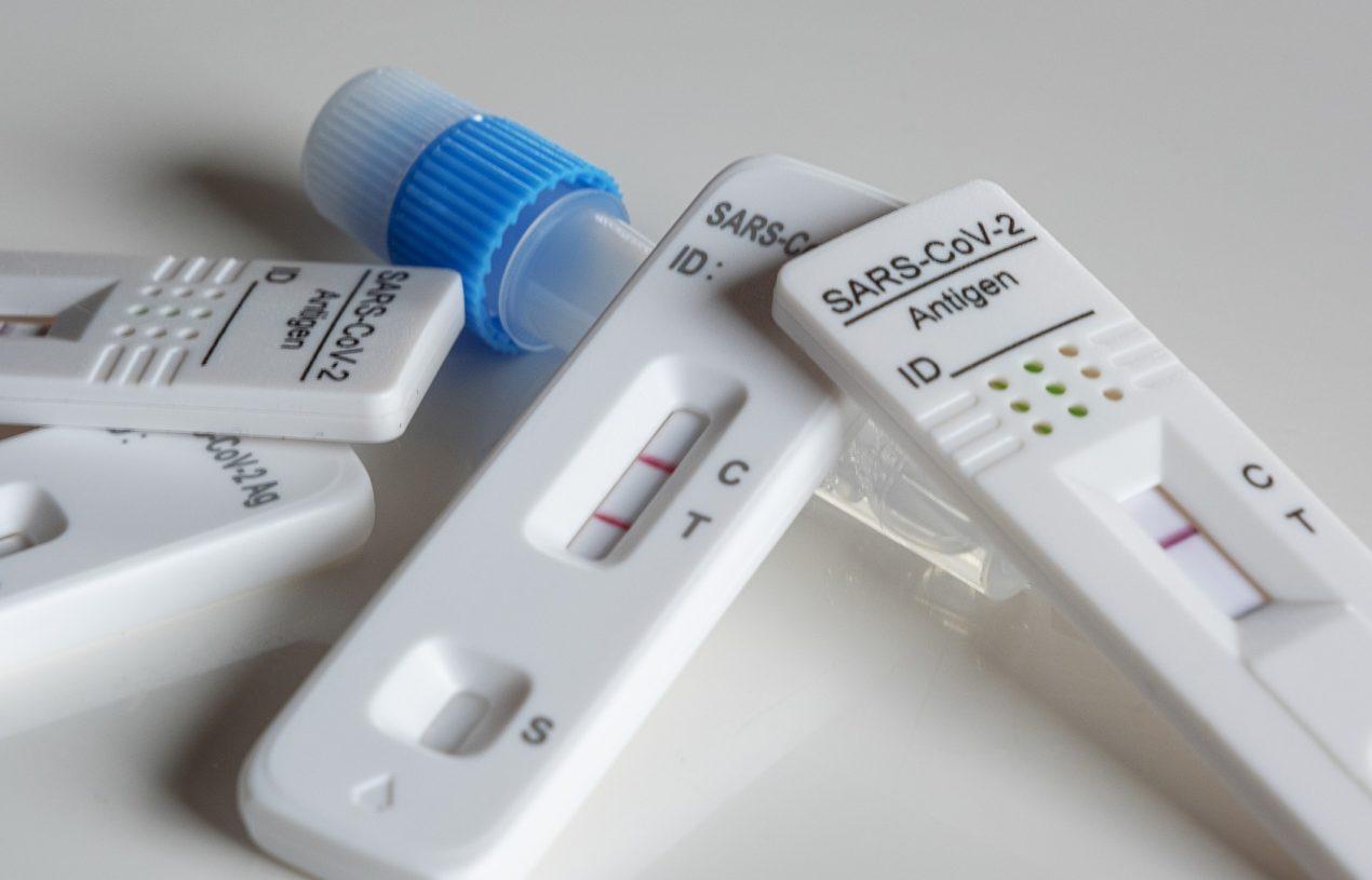 Diagnosticados 577 novos casos e 1.159 recuperações